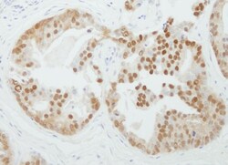 PRMT5 Antibody, Novus Biologicals 0.1 mL | Buy Online | Novus Biologicals | Fisher Scientific
